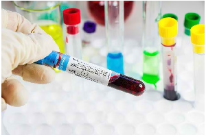 /images/berita/tumbnail/Screenshot 2026-03-10 140732.png